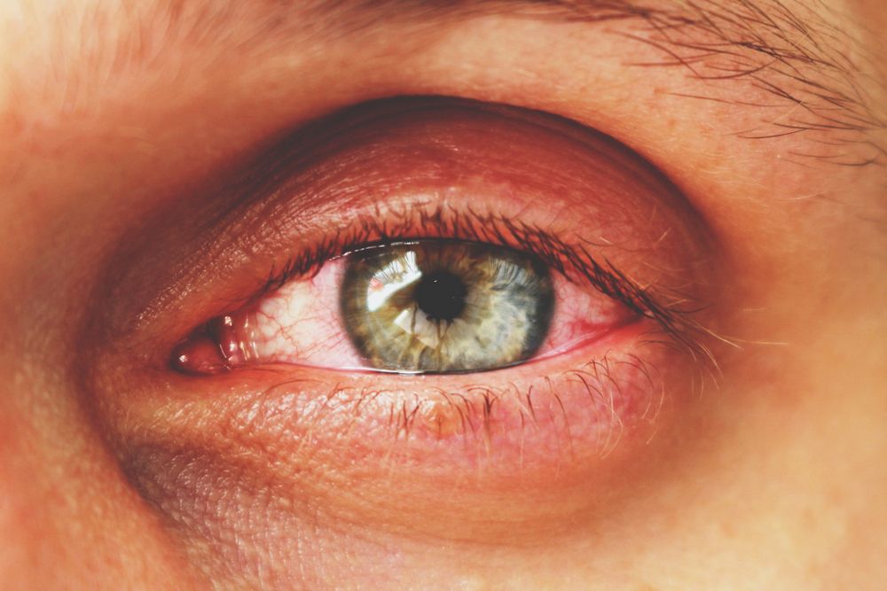 Common Retinal Diseases: Symptoms, Risk Factors, and Early Detection
