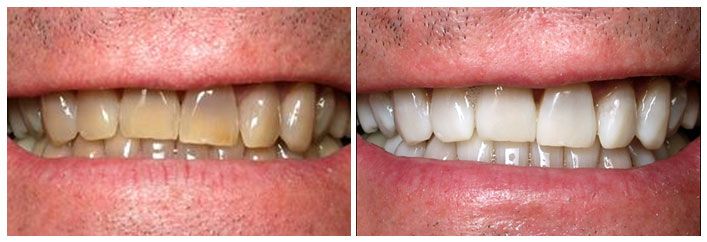 cosmetic dentistry results