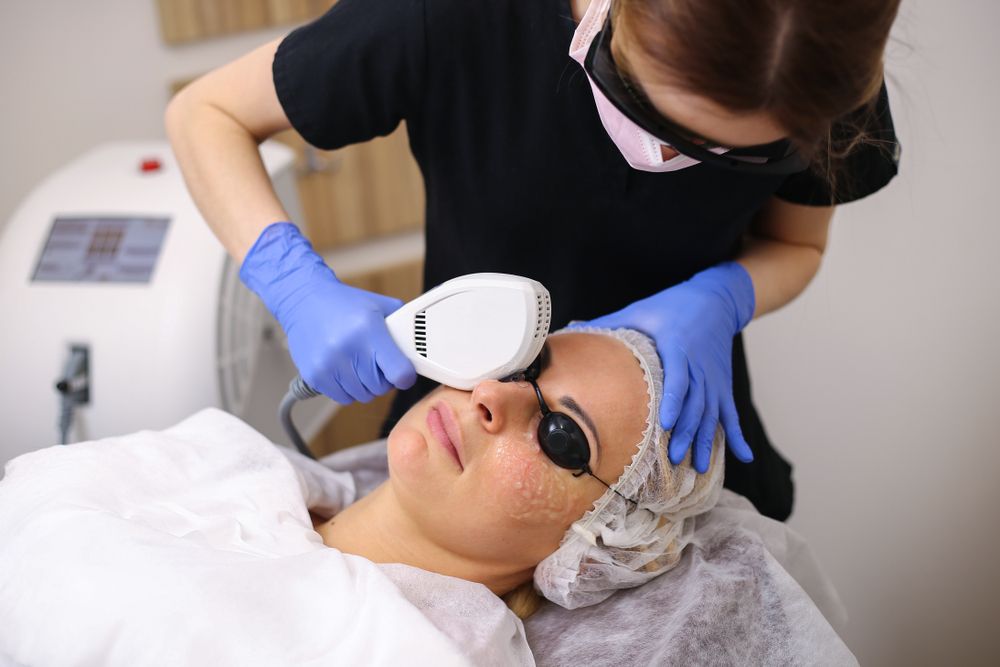 The Benefits of IPL Therapy for Dry Eye Relief