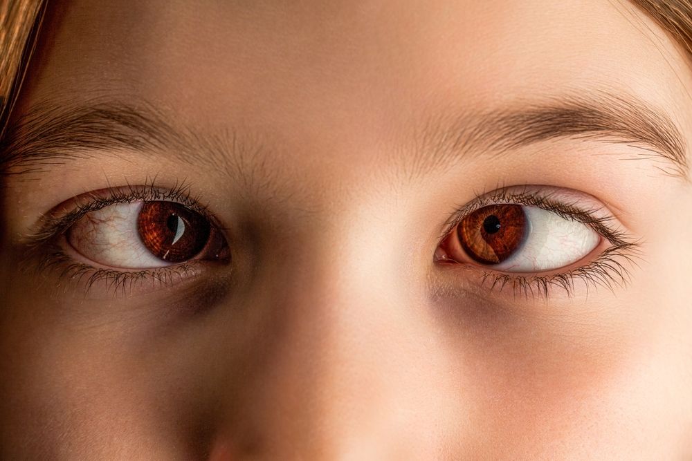 What Are the Signs of Binocular Vision Dysfunction?