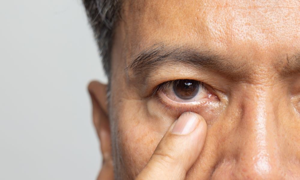 What Is The First Symptom Of Eye Cancer?