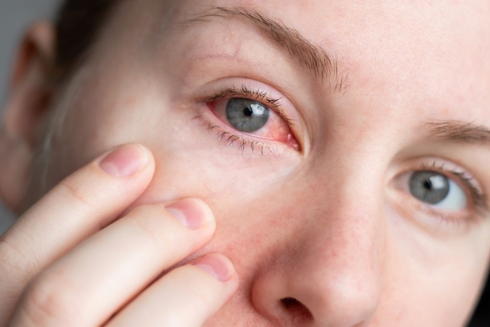 How Seasonal Changes Can Impact Dry Eye Symptoms