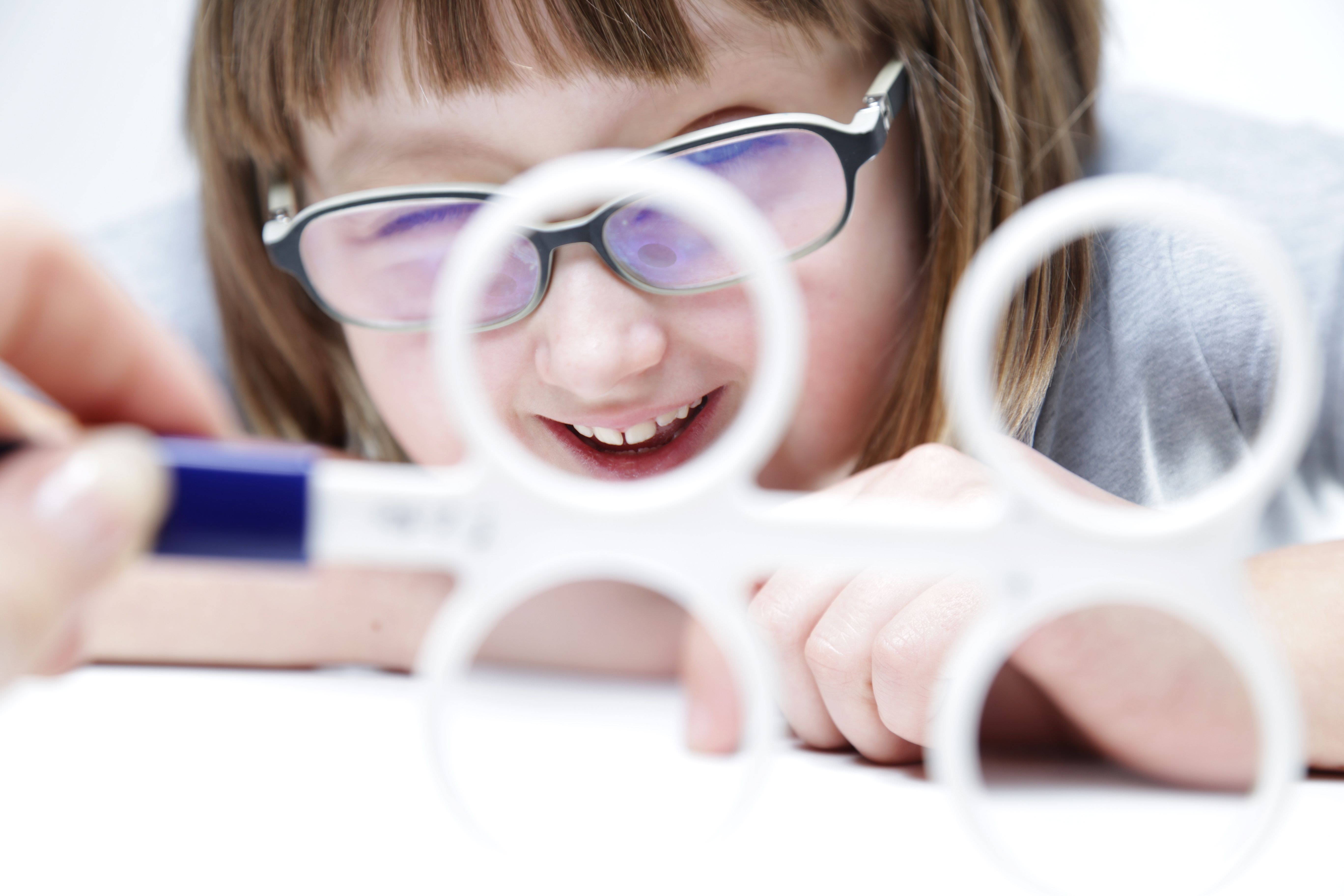 Can Vision Therapy Permanently Fix Amblyopia?