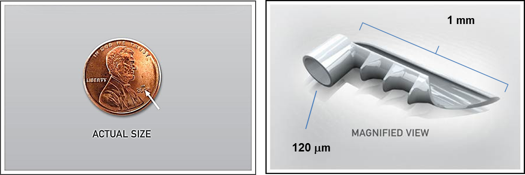 iStent Glaucoma Treatment