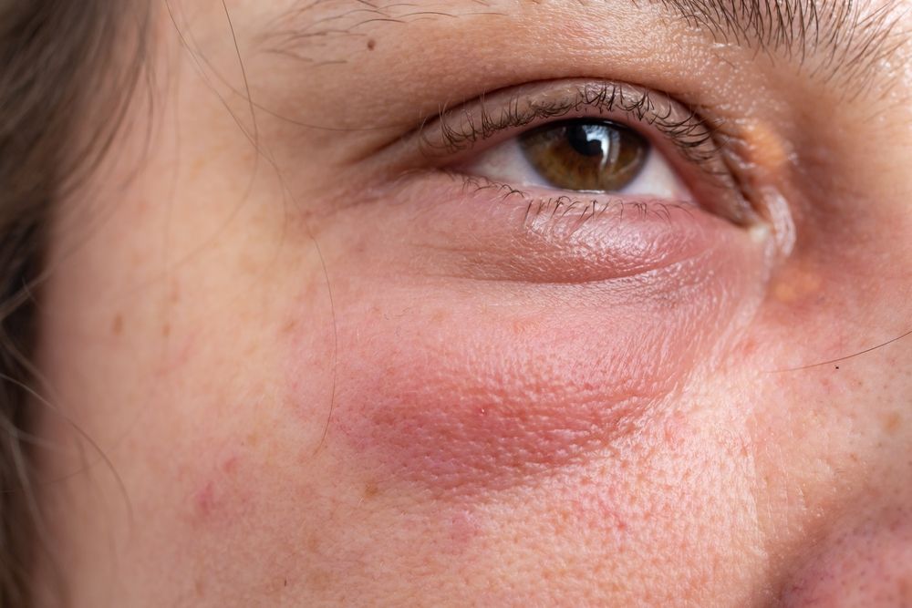 What Are Soft Tissue Facial Injuries? Causes and Symptoms Explained