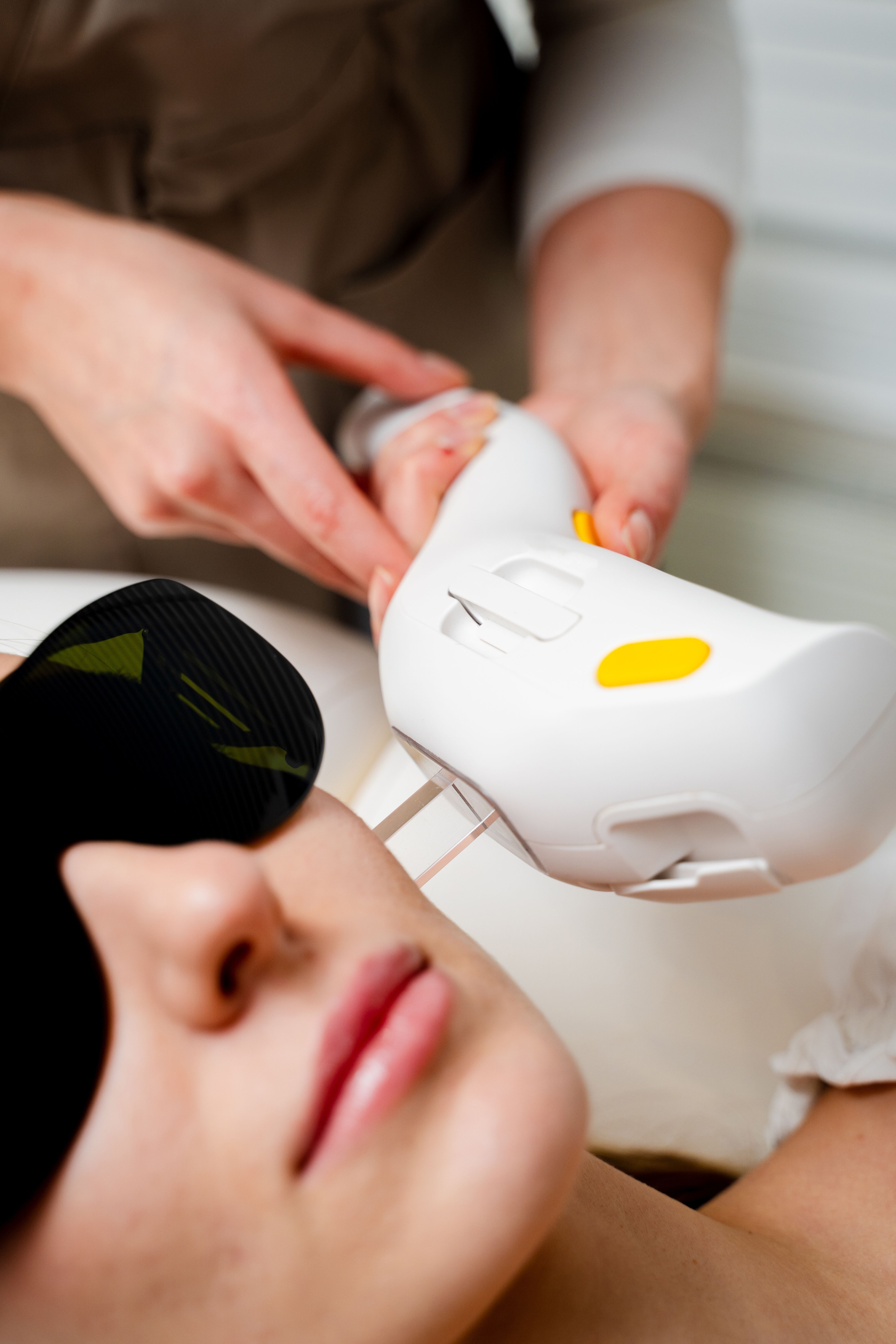 OptiLight for Dry Eye: How IPL Technology Targets Meibomian Gland Dysfunction