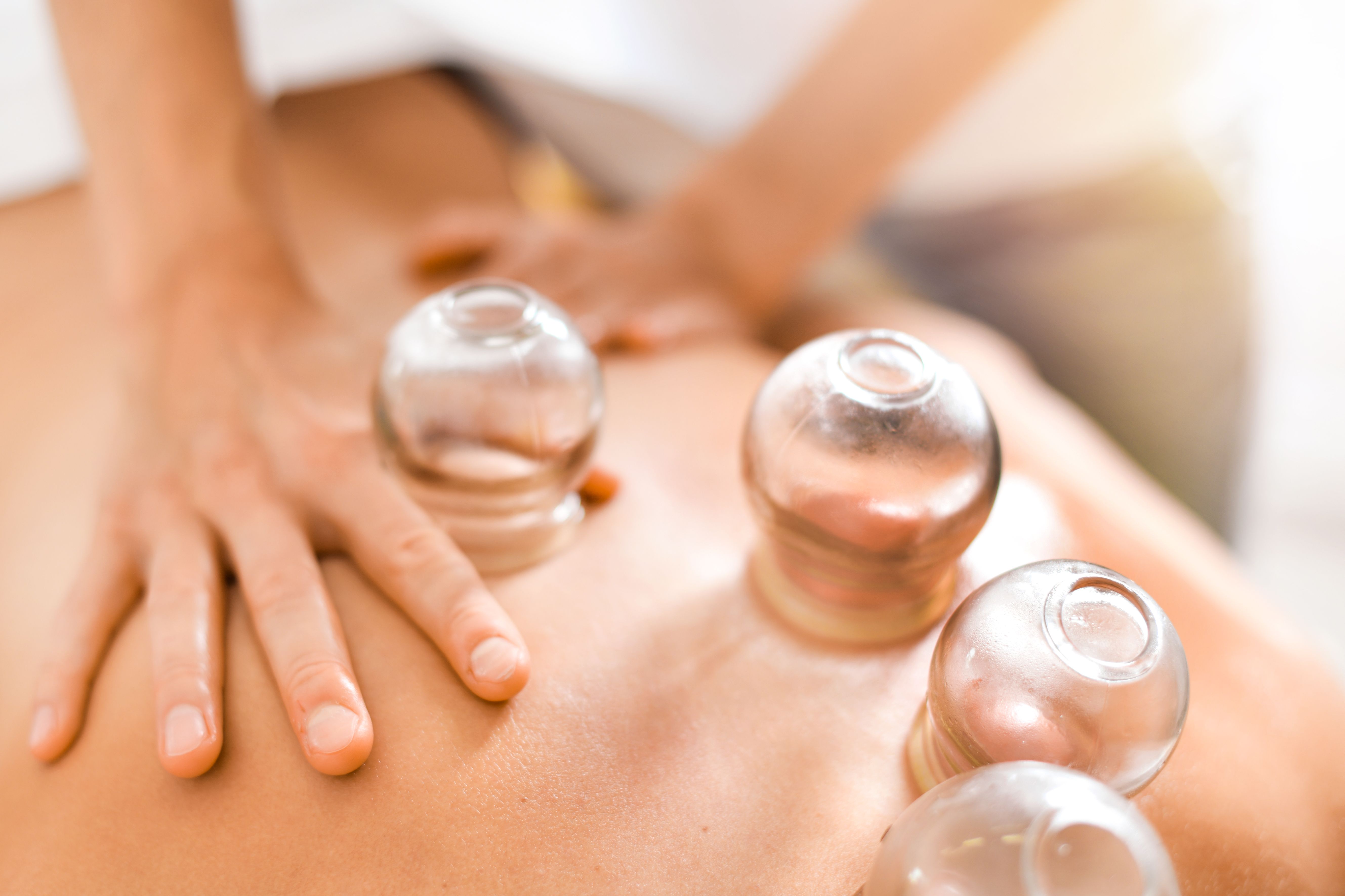The Benefits of Cupping Therapy for Chronic Pain and Tight Muscles