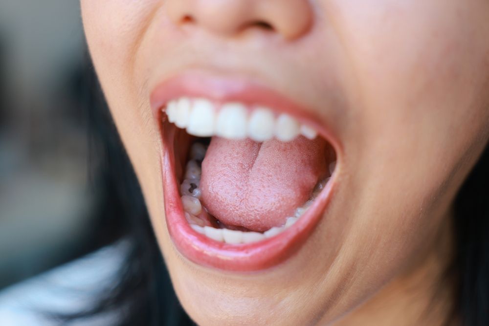Do Dentists Recommend Tongue Scraping?
