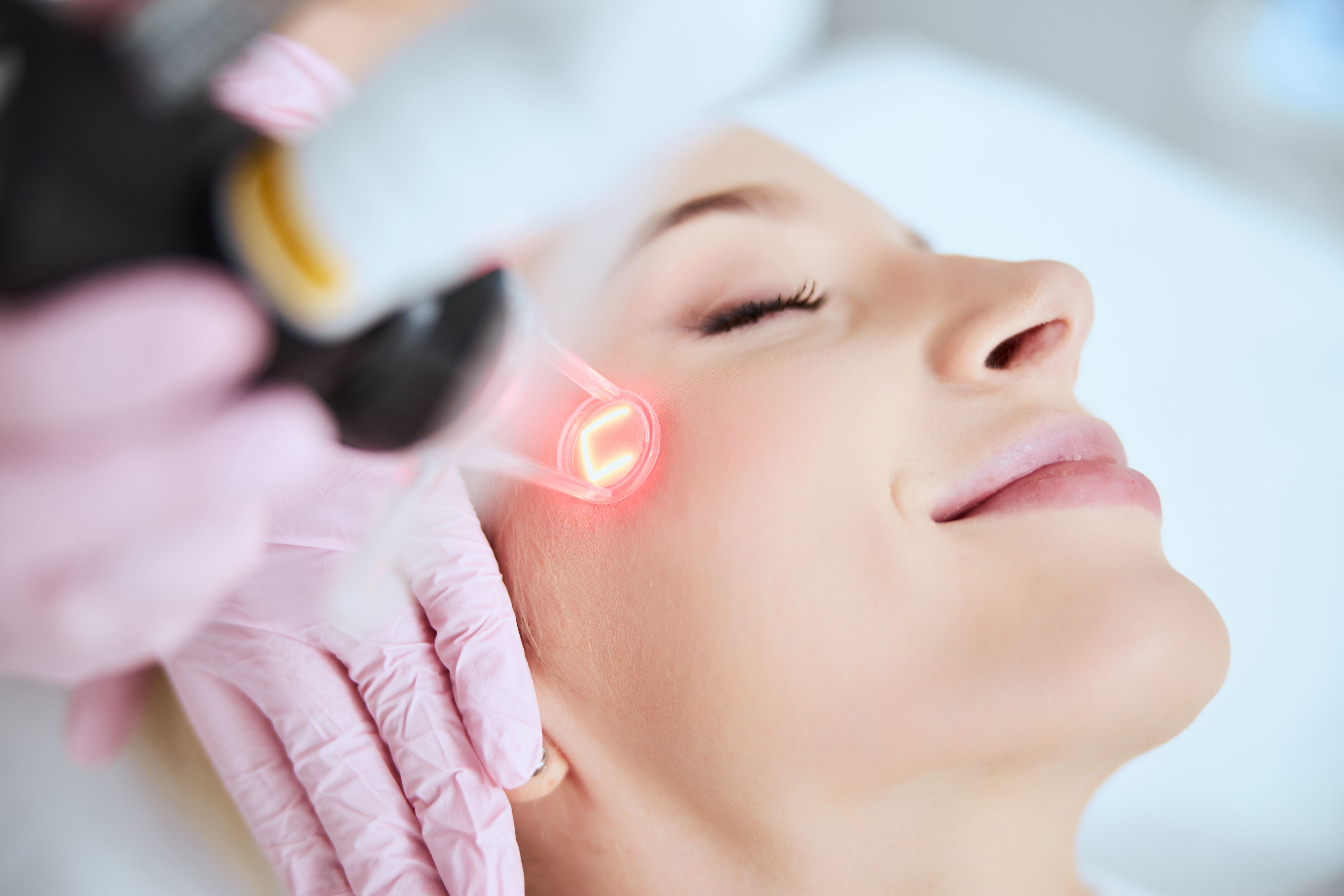 What to Know Before a CO2 Laser Resurfacing
