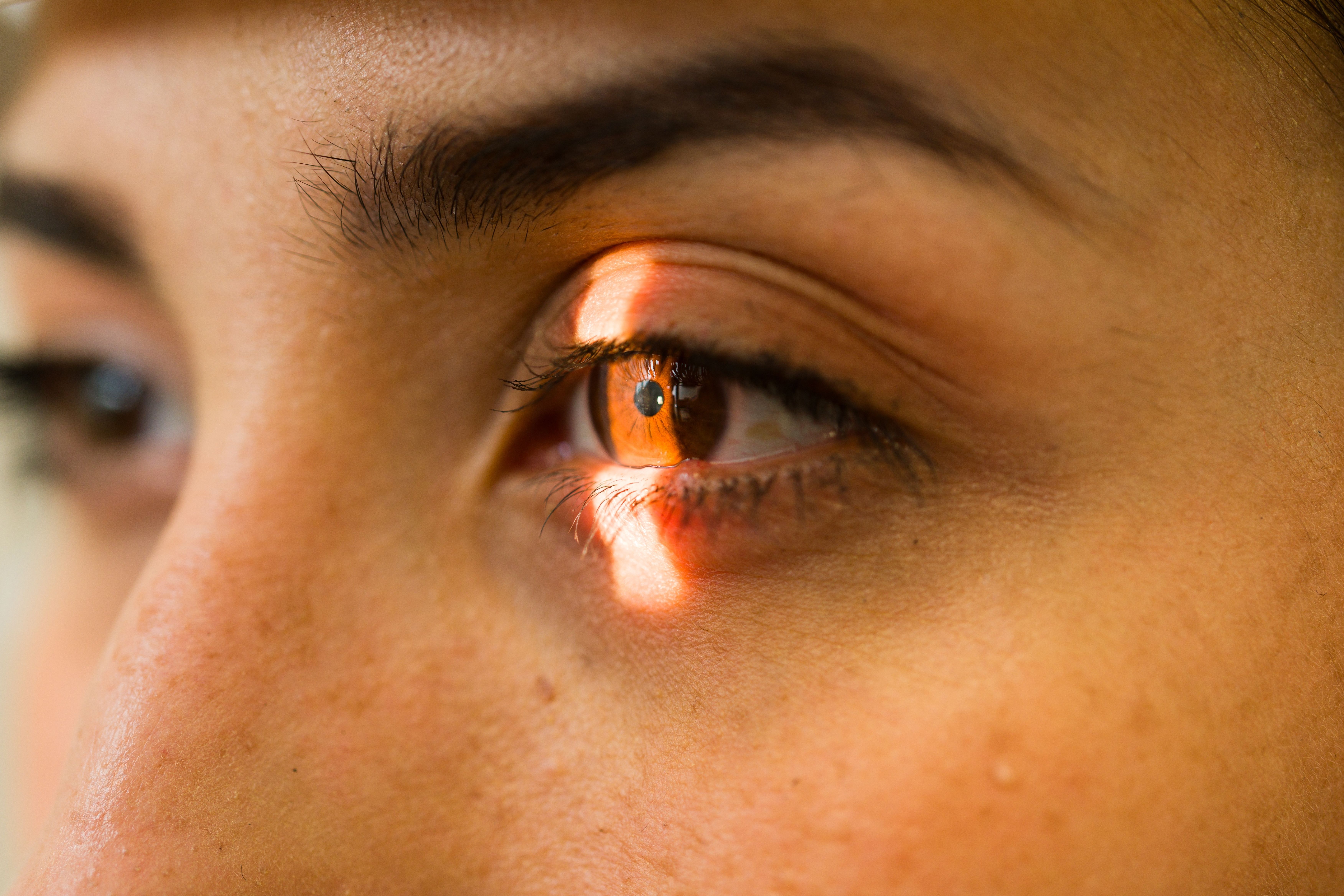 A Guide to Common Eye Conditions: From Dry Eye to Glaucoma