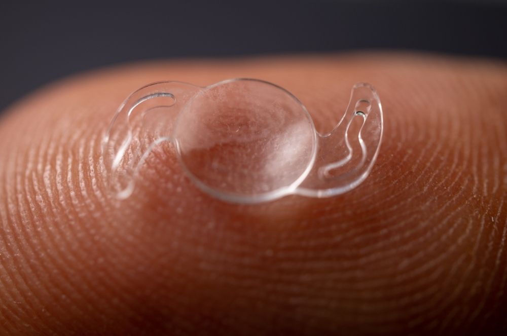 Multifocal vs Monofocal Lenses in Refractive Lens Exchange