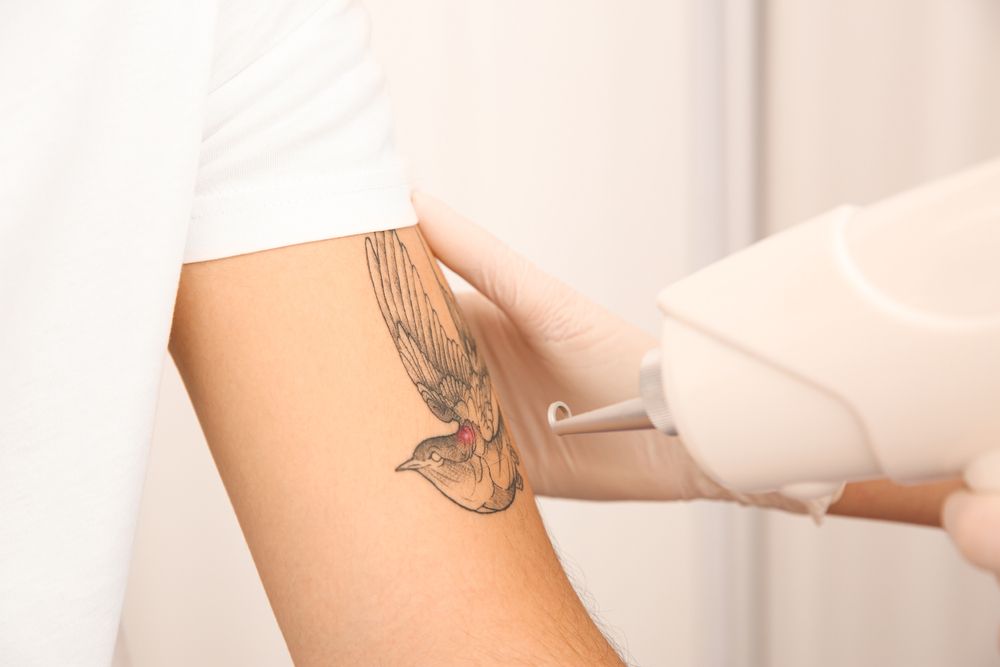 How Tattoo Removal Supports Successful Reentry After Incarceration