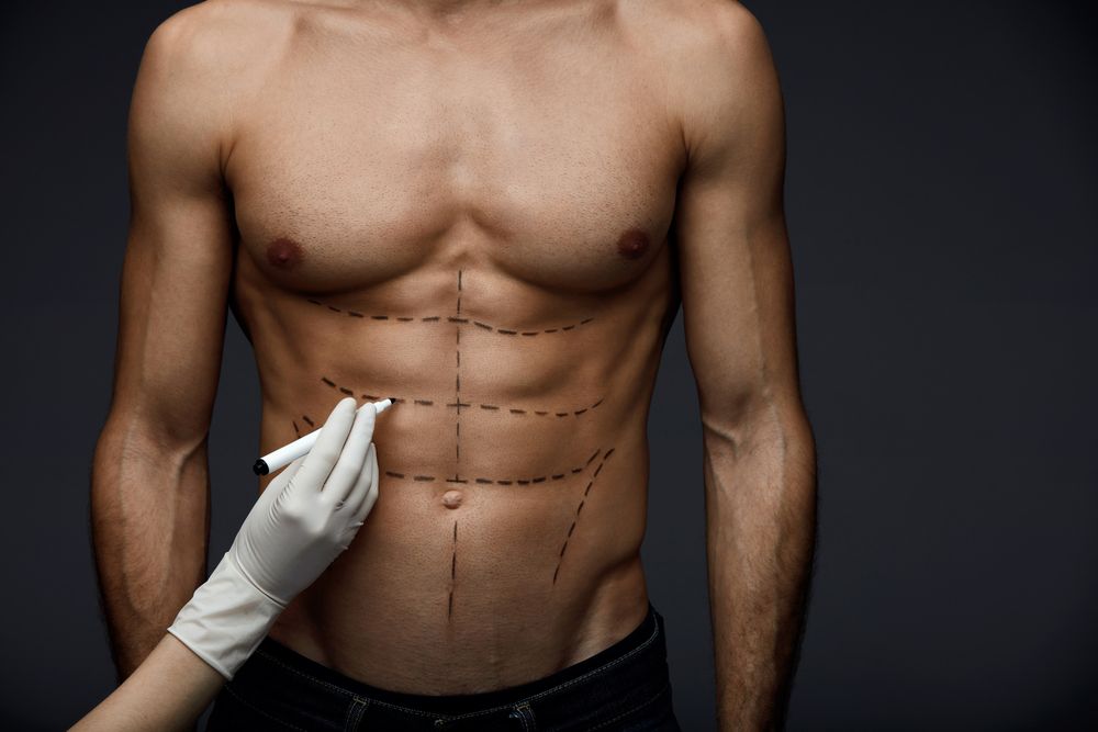Male Body Contouring & Liposuction: Sculpting a More Masculine Physique